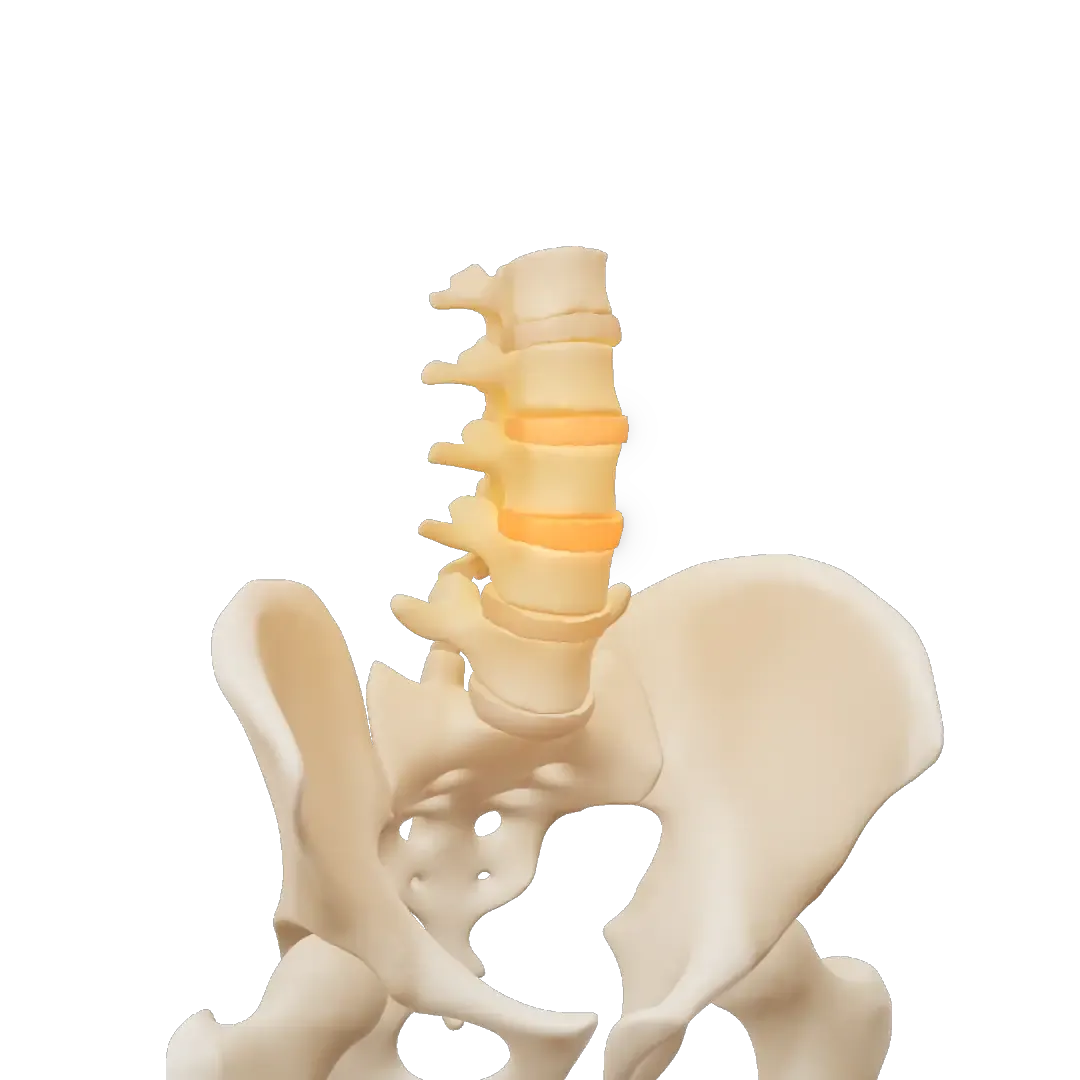 3D-modell av korsryggen og bekkenet med skivene mellom virvlene