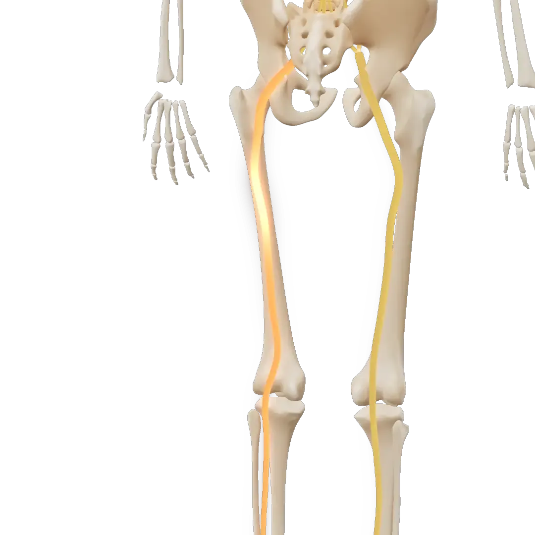 3D-modell av bekkenet og beina med isjiasnerven markert